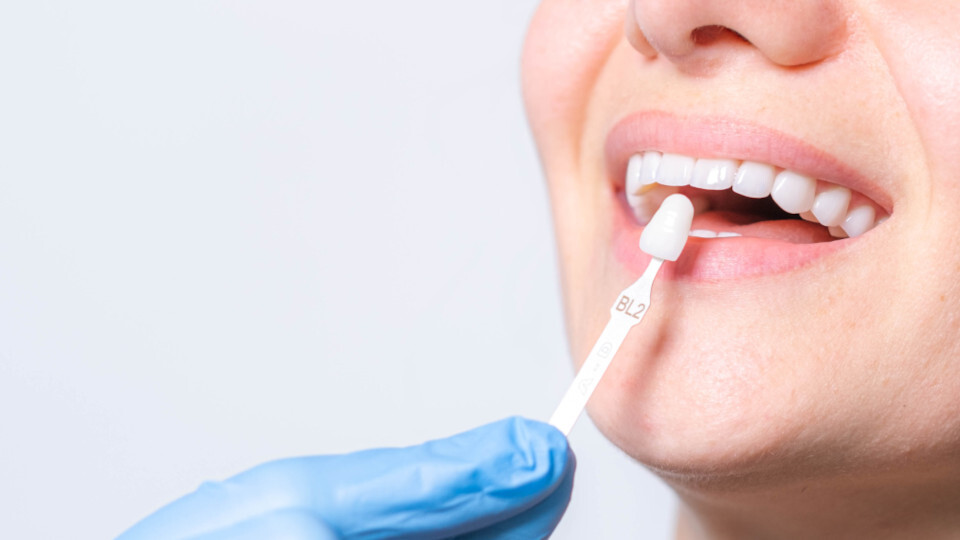 Eine Frau erhält Veneers beim Zahnarzt in Regen
